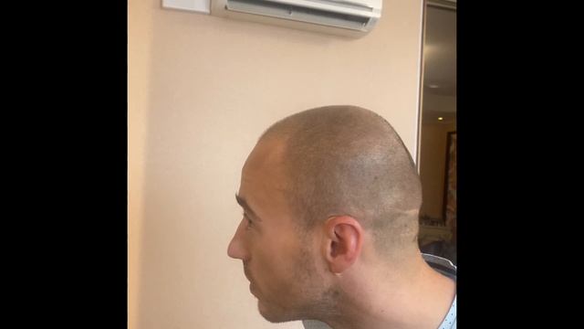 Трихопигментация, татуировка волос в Москве. смотреть онлайн