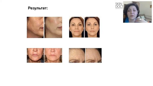 Вебинар с косметологом SkinDoctors Кротовой Еленой смотреть онлайн