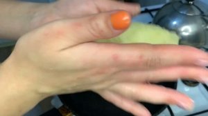 КАРТОФЕЛЬНЫЕ ПИРОЖКИ С СОСИСКОЙ  (ЗРАЗЫ)