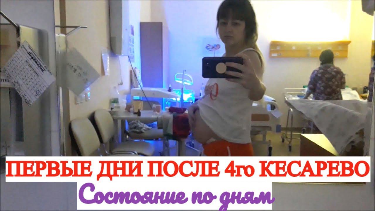 ПЕРВЫЕ ДНИ ПОСЛЕ 4 КЕСАРЕВО СОСТОЯНИЕ ПО ДНЯМ