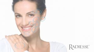 Radiesse 3 (Радиес 3)