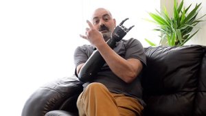 Бионические протезы рук Bebionic©