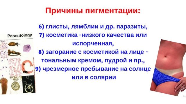 Пигментации на коже Причины