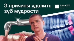 🔧🦷 Зуб мудрости - удалять или нет? Три главных причины для удаления зуба мудрости!