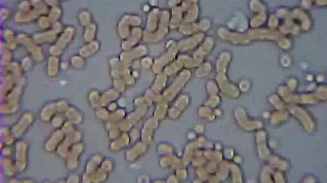 Здоровая и больная клетка крови под микроскопом смотреть онлайн