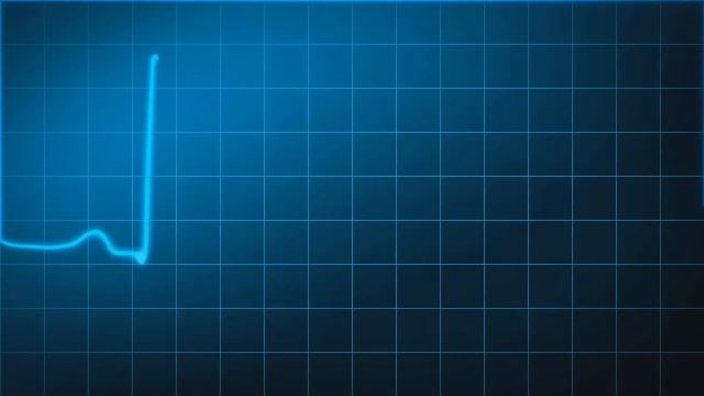 Золотые сундуки сокровищ в Black Desert смотреть онлайн