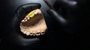 Моделирование зубов из воска