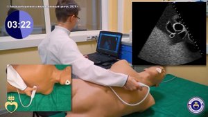 ЭХО КГ. Парастернальный доступ - короткая ось на уровне аортального клапана