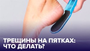 Почему ТРЕСКАЮТСЯ ПЯТКИ? Правила ухода за ногами