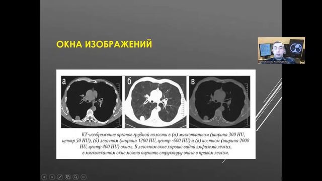 Физические основы рентгеновской компьютерной томографии