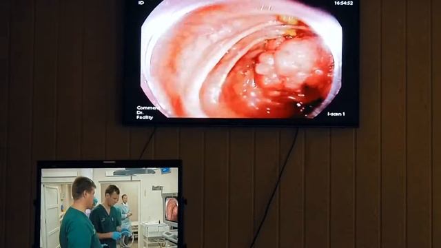 07Live Мальков ВА EMR полипа толстой кишки смотреть онлайн