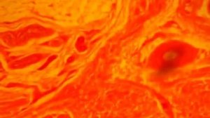 Кожа под микроскопом