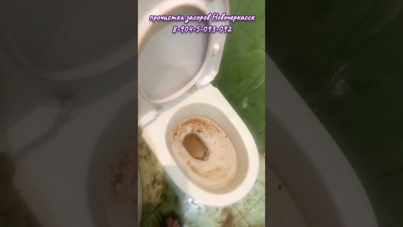 Латентная дисфункция трафика Фи калий.