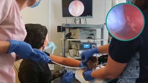 Tracheal collapse dog, tracheal malformation Коллапс/мальформация трахеи Стентирование трахеи собак