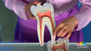 Можно ли поставить на место выбитый зуб? Жить здорово! Фрагмент выпуска от 15.06.2017
