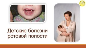 Детские болезни ротовой полости