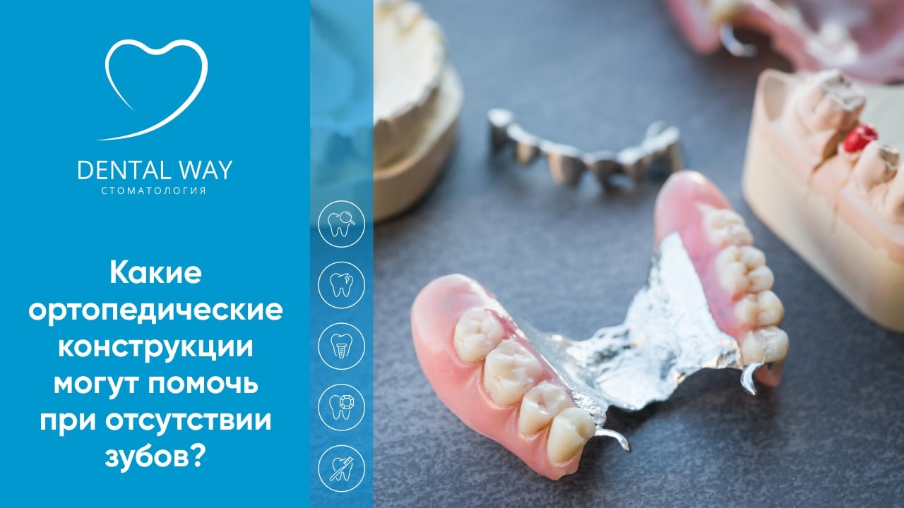 Какие ортопедические конструкции могут помочь при отсутствии зубов