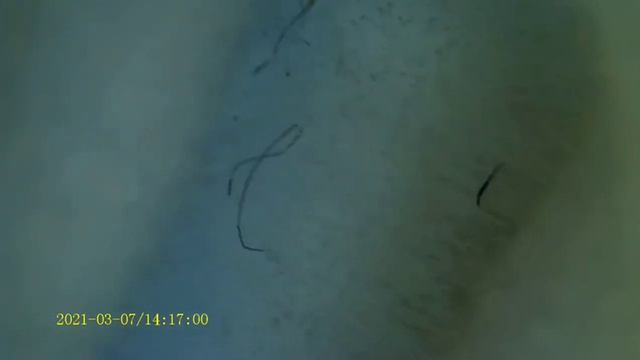 что находится на палочках ковиd-теста??? смотреть онлайн