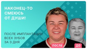 Имплантация всех зубов Straumann. Как быстро вернуться к полноценной жизни?