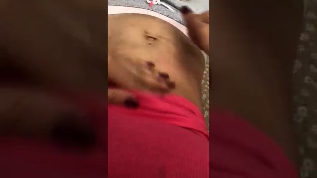 Фитнесмама. Массаж подушечками пальцев.