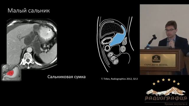 Кирилл Петров. Анатомия и семиотика поражений брюшины.