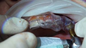 Спасибо, Хосе 3. IDR.