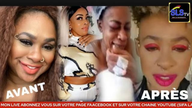 ? Nathalie Makoma et Grâce Mbizi voici les conséquences du chirurgie plastique