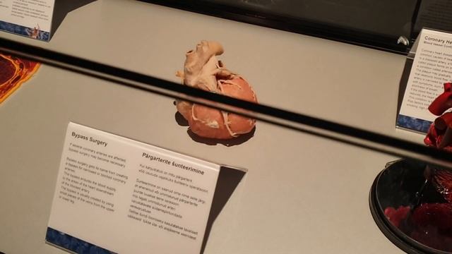Body Worlds в Таллине.Выставка тела человека в Эстонии в Т1.Интересные места в Таллине.Влог