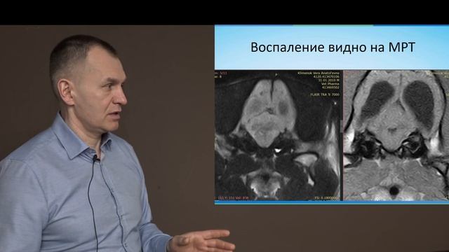 Конференция в Симферополе. Средний отит причины, диагностика, лечение, как не допустить рецидива. смотреть онлайн