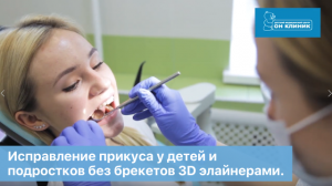 Исправление прикуса у детей и подростков без брекетов 3D элайнерами.