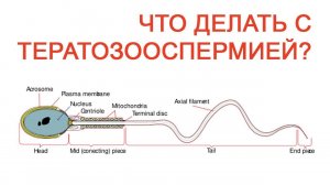 Что делать с Тератозооспермией? / Доктор Черепанов