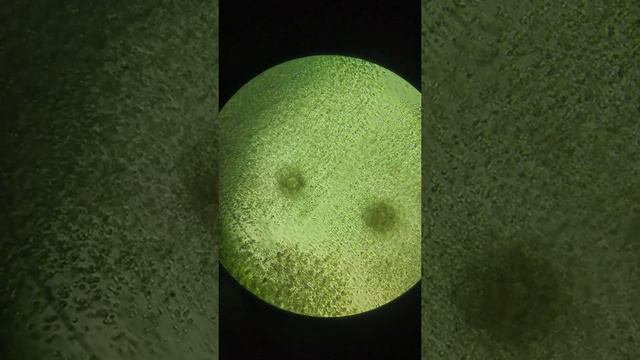 Human oocyte-cumulus complexes immediately after aspiration from the ovarian follicle смотреть онлайн