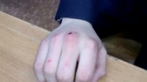 № 49 ИГРАЕМ В КОПЕЕЧКУ ДО КРОВИ