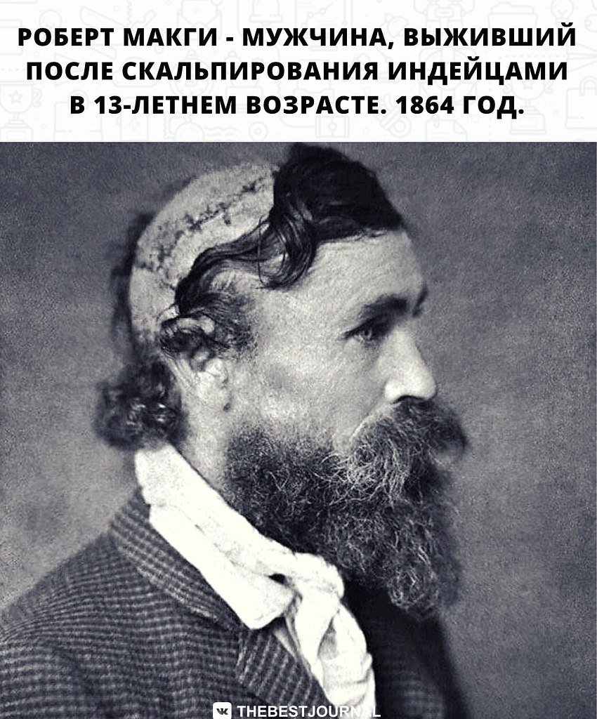 Как правильно снимать скальп