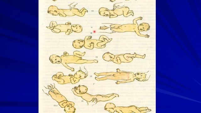Физиология новорожденных детей.mp4