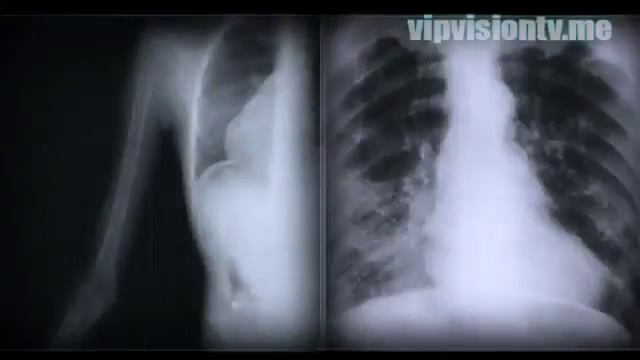 Как вывести радиацию смотреть онлайн