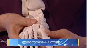 «Косточки» на стопе. Школа здоровья. GuberniaTV