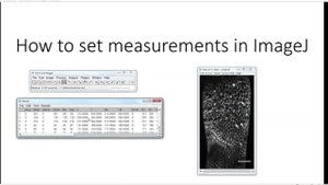 5. How to set measurements in ImageJ