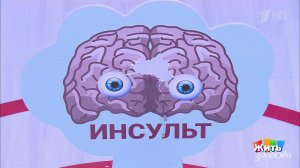 Спасти от инсульта. Прорыв XXI века. Жить здорово! Фрагмент выпуска от 29.10.2020