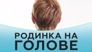 Удаление родинок на голове.