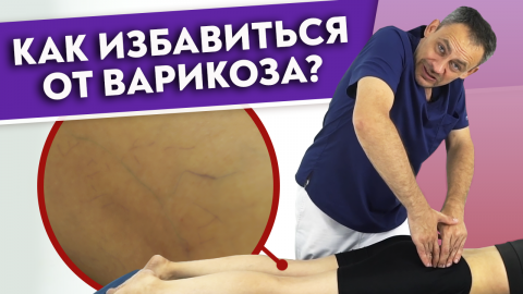 Как убрать ВАРИКОЗ?
Варикозное расширение вен — причины и лечение.
