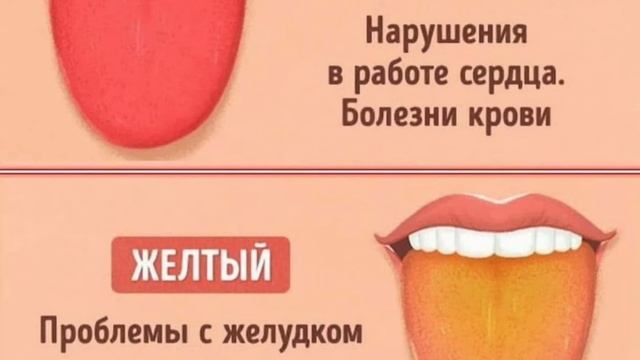 Що означає ярко-красный и желтый язык. смотреть онлайн