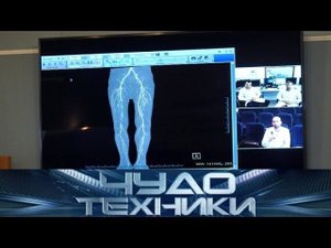 "Чудо техники": Секреты «телемедицины» и все о химчистке на дому (22.04.2018)