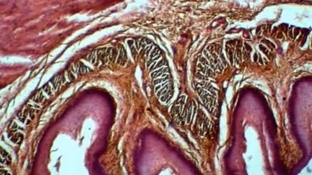 05 Esophagus, Cat GIT CD histo смотреть онлайн