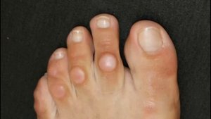 КАК ИЗБАВИТЬСЯ ОТ МОЗОЛЕЙ, ПЯТЕН НА ОДЕЖДЕ/ТРЮКИ С АСПИРИНОМ ЧАСТЬ ВТОРАЯ