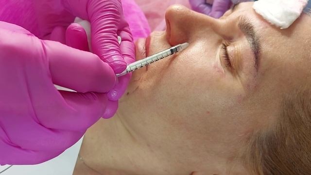 Токсин. Элементы техник. смотреть онлайн