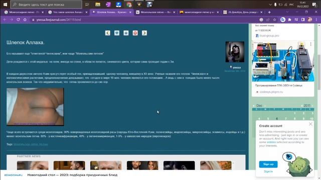 Монголоидное пятно. Уникальные Дети. Шлепок Аллаха. Отметина Чингисхана. Медаль на попе.