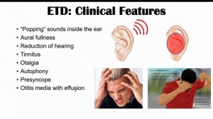 Eustachian Tube Dysfunction (“Popping Sound in Ears”) | Causes, Symptoms, Diagnosis, Treatment