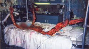 Самый радиоактивный человек в истории