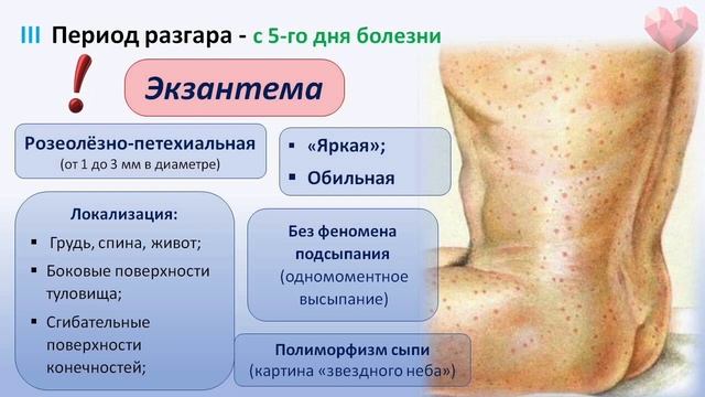 PRОСТО О СЛОЖНОМ. Сыпной тиф ч.2. Инфекционные болезни №2